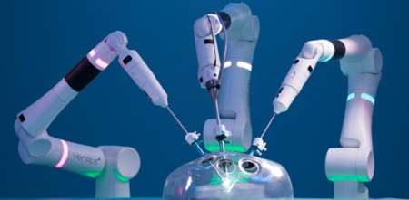 Robots en cirugía: precisión vs. costos en la nueva frontera del quirófano