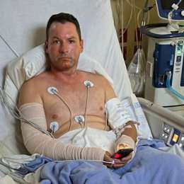 La salud de Trebbiani tras sufrir quemaduras