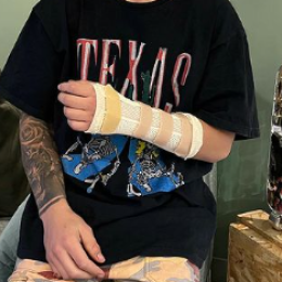 El ex campeón de MotoGP que se quebró entrenando en motocross