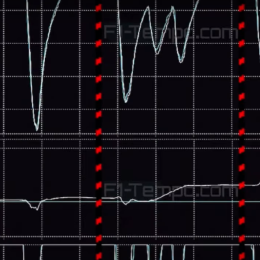 Debut de Colapinto en F1: ¿Qué dice la telemetría?