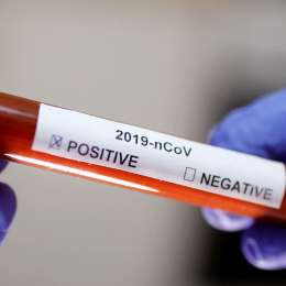 ''El Coronavirus te deja tirado como un perro''