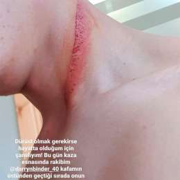 Milagro, el disco de freno de Binder casi le corta el cuello a un rival