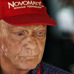 Lauda esta mucho mejor según su hermano