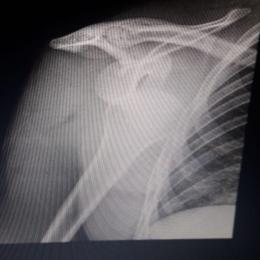 El Superbike Argentino clasificó en Buenos Aires