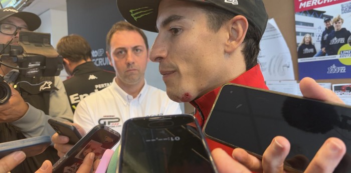 MotoGP: La irónica frase de Marc Márquez tras su golpe: "Me dieron puntos en la pera, pero no suman para el campeonato"