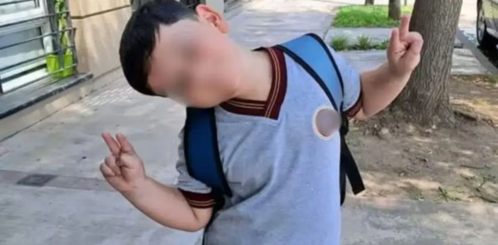 ¿Cómo sigue la salud del niño atropellado en la Frontera de Pinamar?