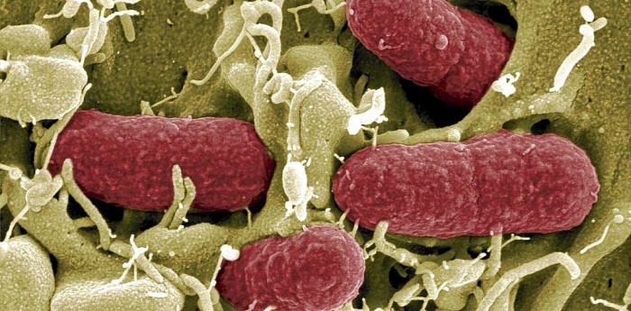 La batalla contra las superbacterias: la amenaza silenciosa que preocupa a la medicina mundial