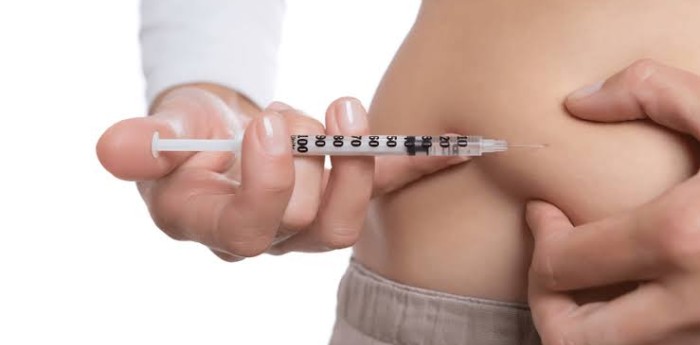 La revolución de los nuevos medicamentos contra la obesidad: cómo están cambiando el tratamiento de una enfermedad compleja