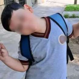 ¿Cómo sigue la salud del niño atropellado en la Frontera de Pinamar?