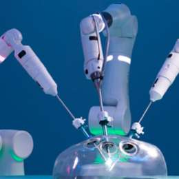 Robots en cirugía: precisión vs. costos en la nueva frontera del quirófano