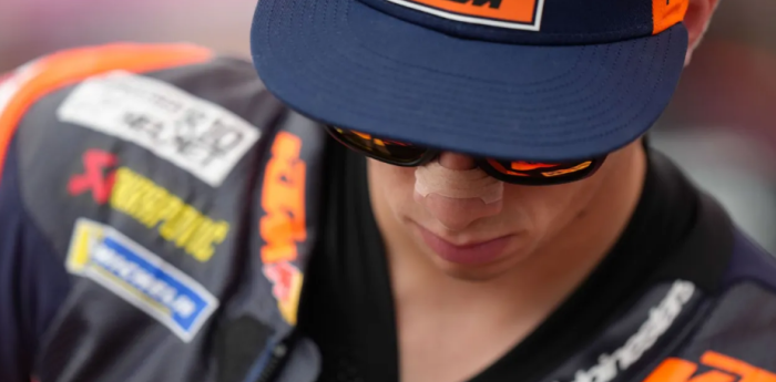 MotoGP: Pedro Acosta fue operado del antebrazo derecho
